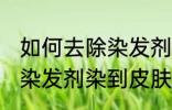 如何去除染发剂染在皮肤上的颜色 被染发剂染到皮肤如何处理